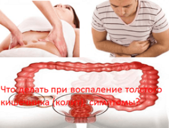 Что делать при воспалении толстого кишечника (колите), симптомы?