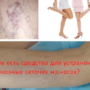 Какие есть средства для устранения варикозных сеточек на ногах?