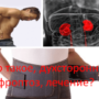 Что такое, двухсторонний нефроптоз, лечение?