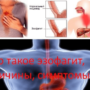 Что такое эзофагит, причины, симптомы?