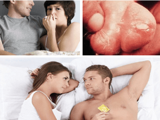 Какие признаки венерических заболеваний у мужчин?