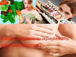 Какие витамины принимать при мастопатии?