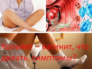 Кольпит – вагинит, что делать, симптомы?