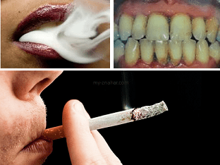 Курение: вред и последствия после