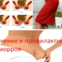 Лечение и профилактика геморроя