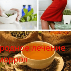 Народное лечение геморроя
