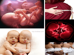 Особенности родов при многоплодной беременности