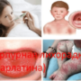 Пурпурная лихорадка (скарлатина)