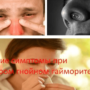 Симптомы острого гнойного гайморита