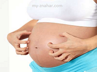 Что делать, если чешется тело во время беременности
