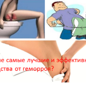 Какие самые лучшие и эффективные средства от геморроя?
