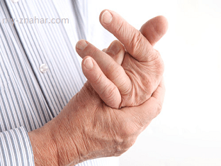 Как лечить артрит пальцев рук