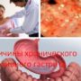 Причины хронического эрозивного гастрита
