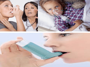 Какие осложнения бывают при бронхиальной астме