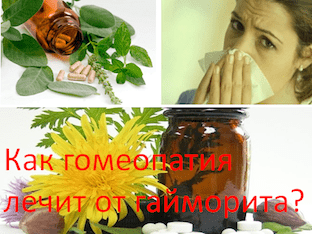 Лечение гайморита гомеопатией