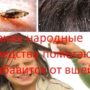 Какие народные средства помогают избавиться от вшей?