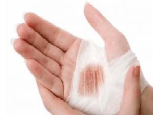 Чем лечить гнойные раны в домашних условиях