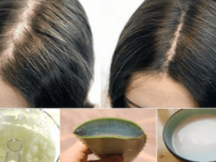 Выпадение волос: как остановить