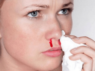 Почему идёт кровь из носа у взрослого человека