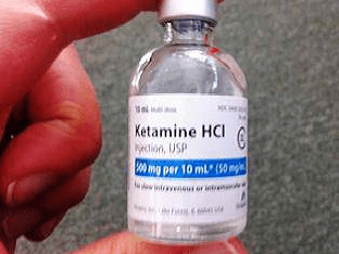 Кетамин: его использование в комплексном региональном синдроме боли и главном депрессивном расстройстве