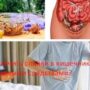 Как лечить спайки в кишечнике народными средствами?