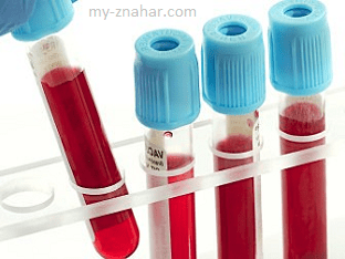 Какие симптомы завышенного уровня гемоглобина в крови