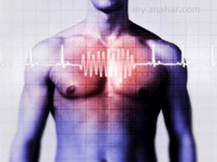 Как лечить аритмию сердца