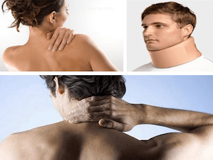 Шейный миозит, что делать если болят мышцы шеи