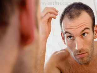 Выпадение волос и их лечение