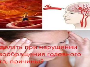 Что делать при нарушении кровообращения головного мозга, причины