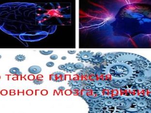 Что такое гипоксия головного мозга, причины