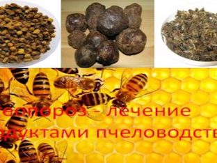Остеопороз - лечение продуктами пчеловодства