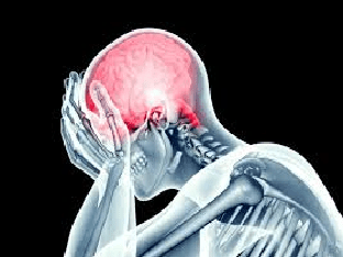 Сдавление головного мозга: чем проявляется, как лечить