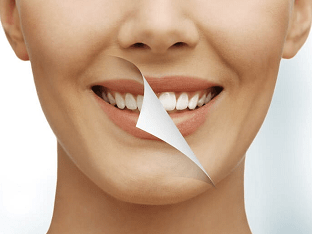 Как отбелить зубы в домашних условиях без вреда эмали