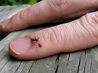 Как лечить комариные укусы быстро и эффективно