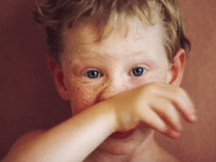 Простуда у ребенка: симптомы и лечение заболевания